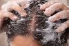 Dandruff Control: Balance Over Aggression – Ayurveda