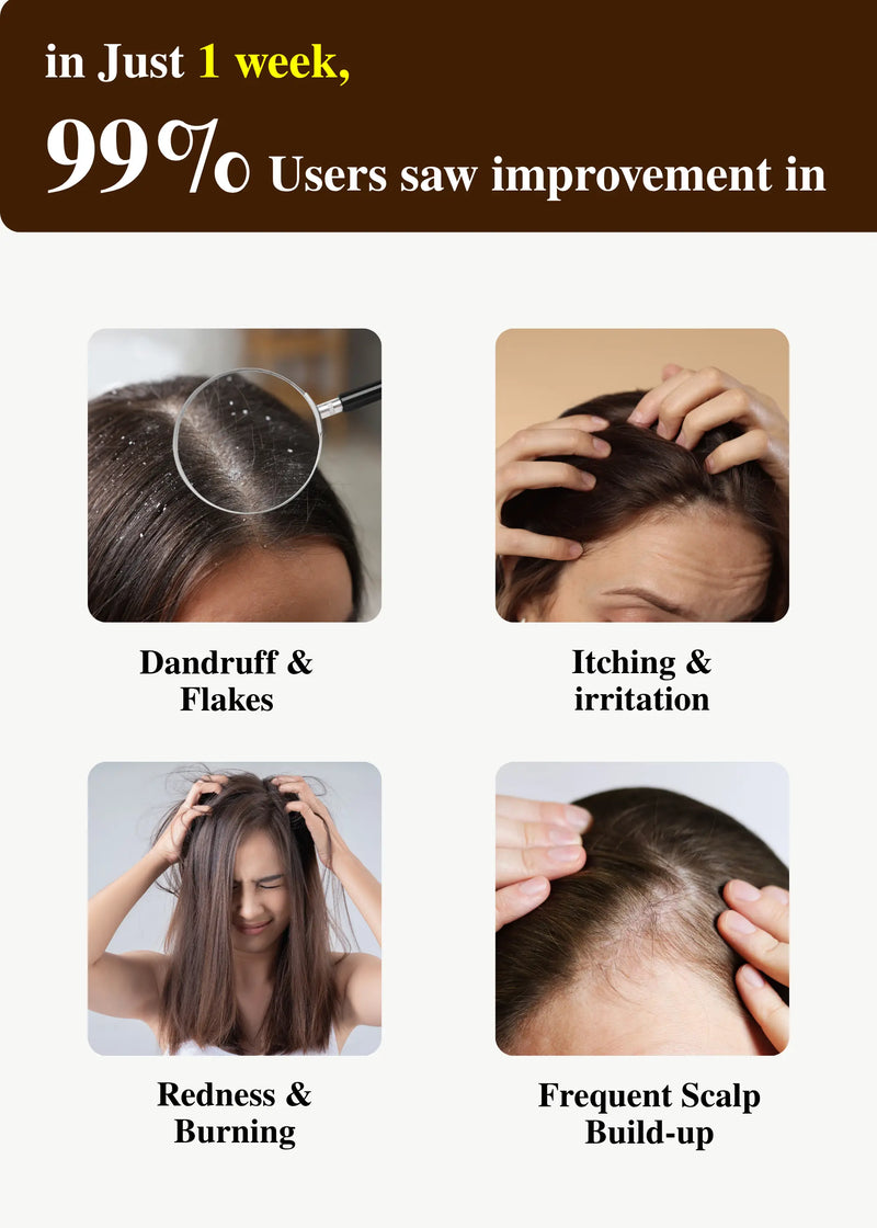 ClariScalp Active Scalp Drops