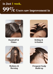 ClariScalp Active Scalp Drops