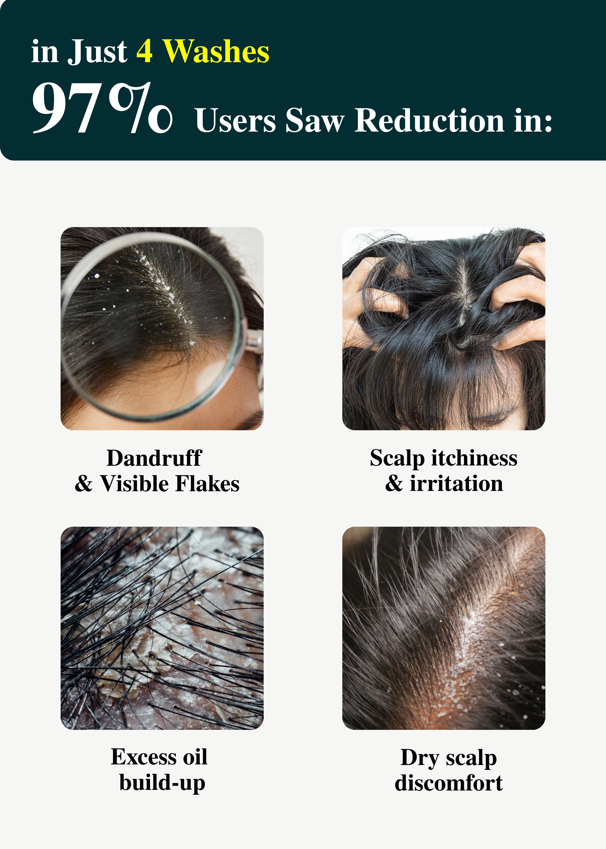 ClariScalp Anti Dandruff Shampoo