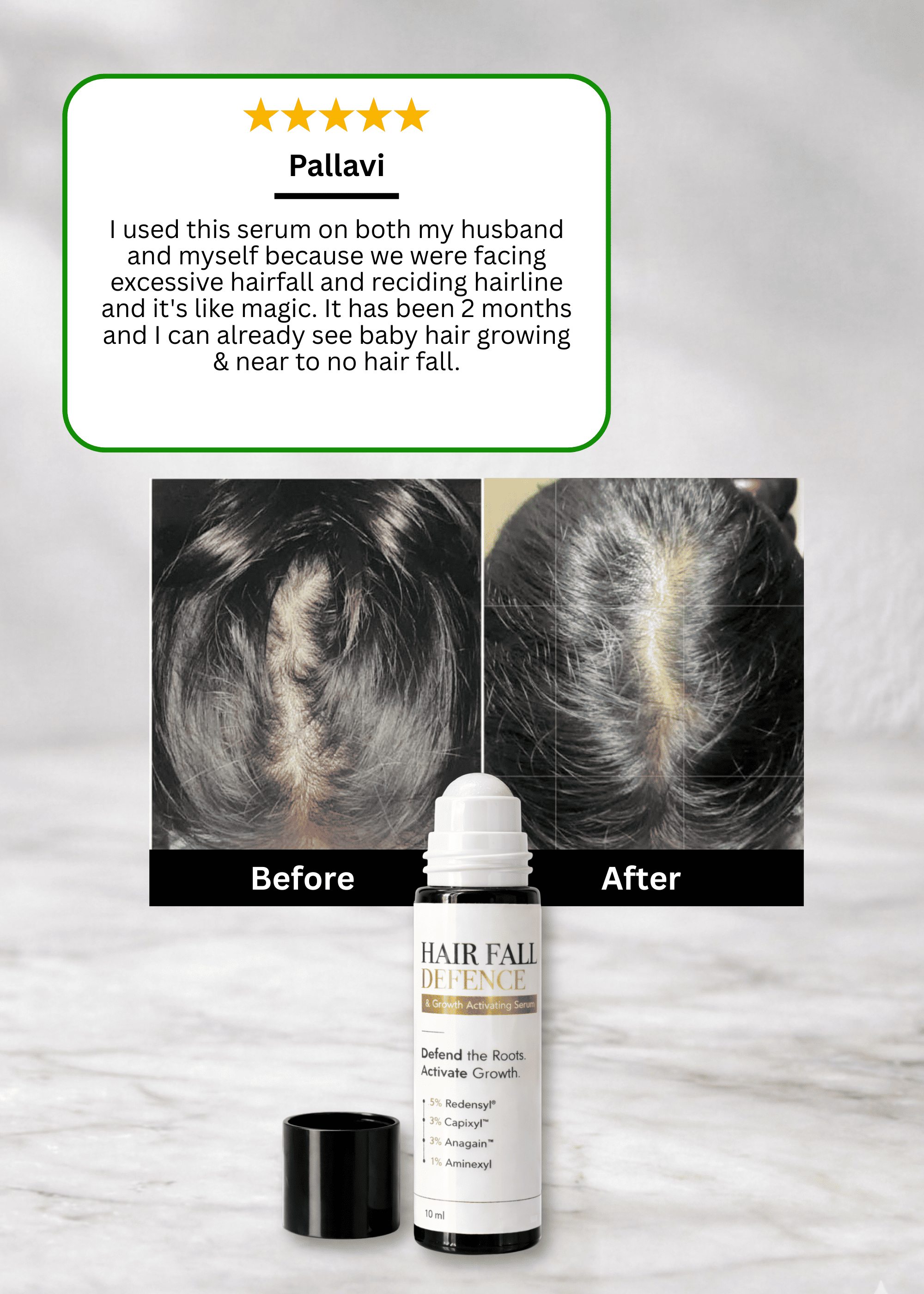 Hair Fall Defence & Growth Activating Serum