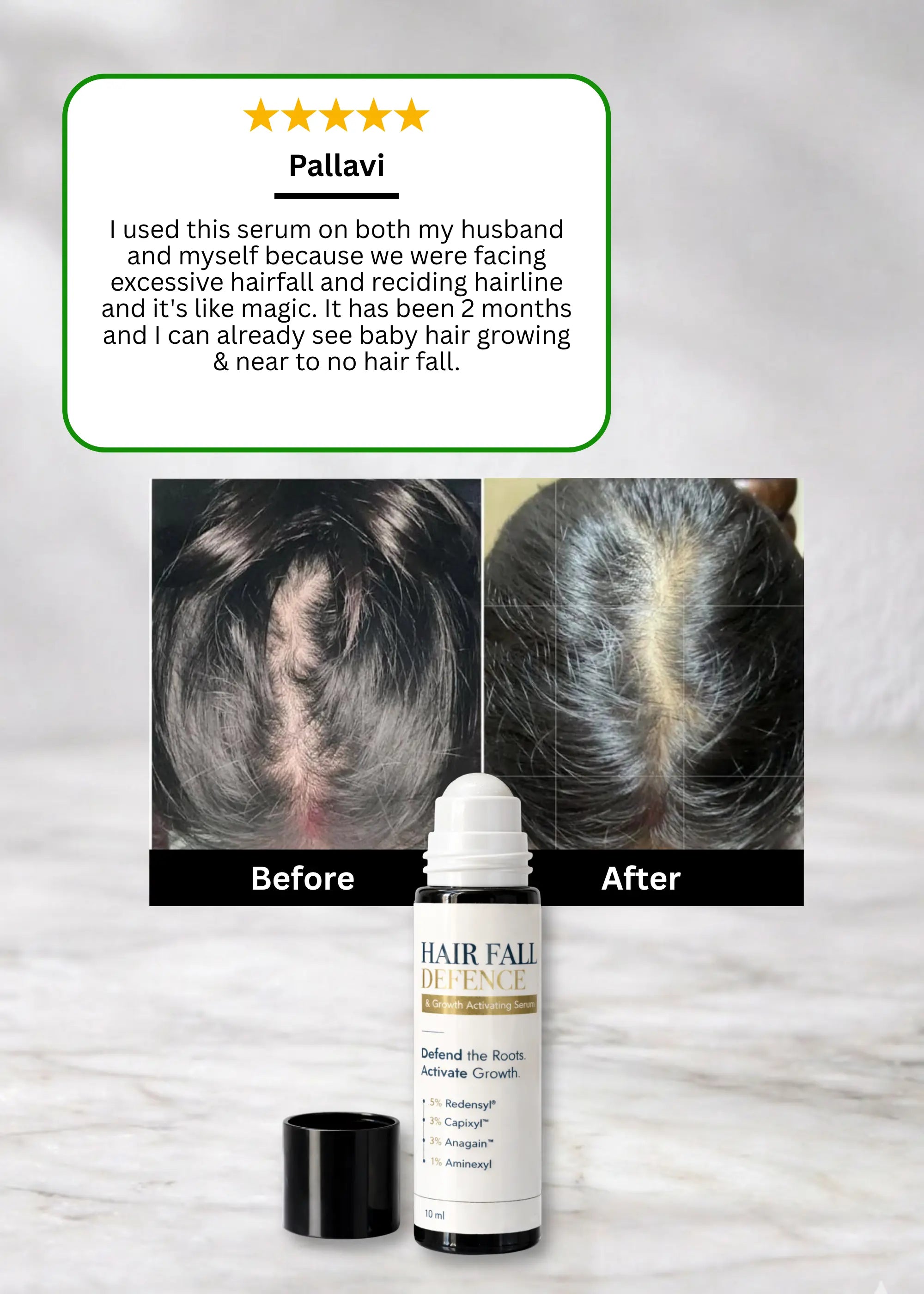 Hair Fall Defence & Growth Activating Serum