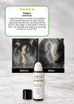 Hair Fall Defence & Growth Activating Serum